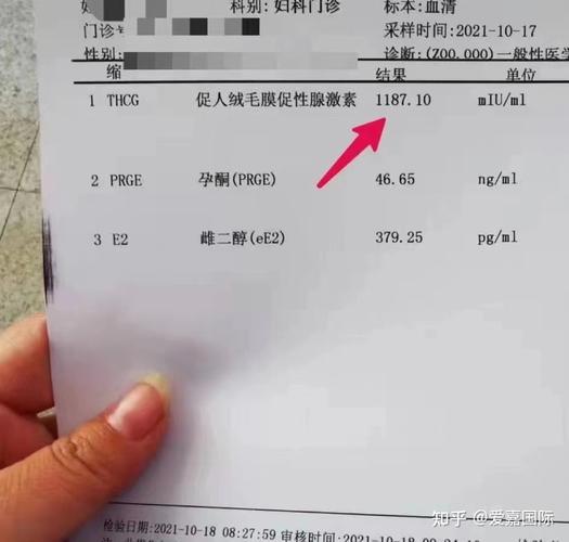 代生儿子包成功多少费用-代生儿子包成功费用查询