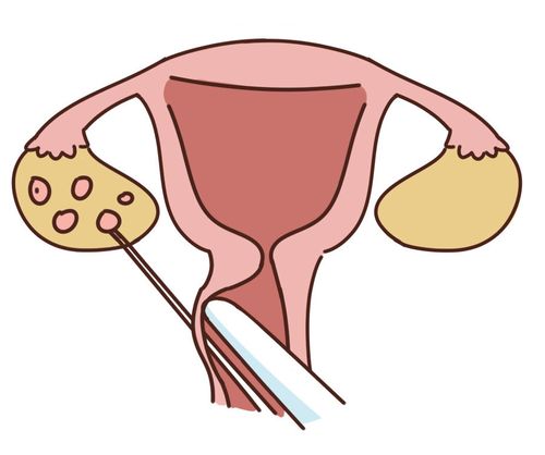 借卵代生孩子全包【借卵代生孩子全包：一站式解决生育难题】